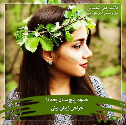 جراحی بینی 99