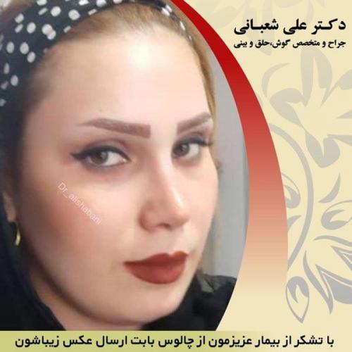 عمل بینی 10