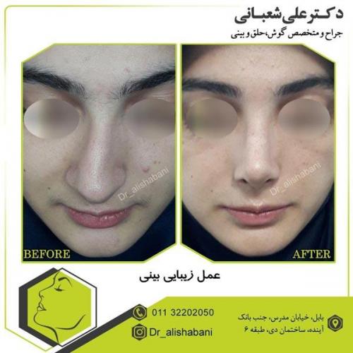 عمل بینی