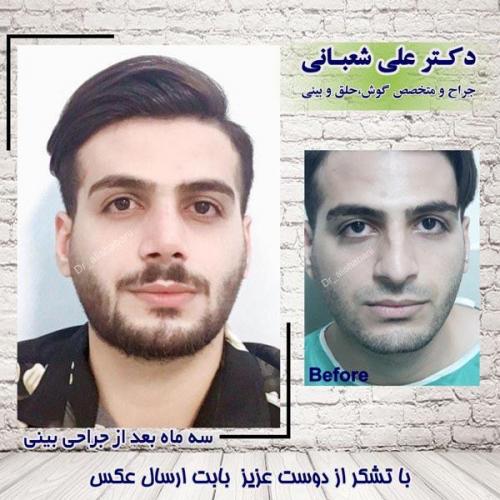 عمل بینی