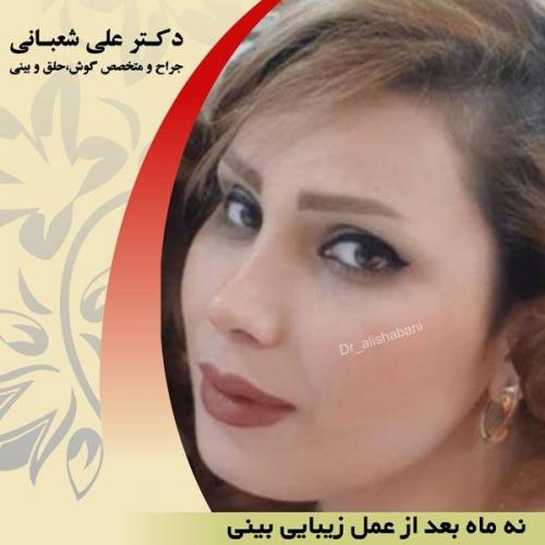 عمل بینی 9
